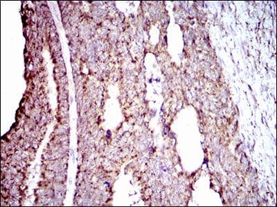 Monoclonal Mouse anti-Human ALDH2 Antibody (clone 4G6A3, Amino Acid: 317-517, IHC, IF, WB)