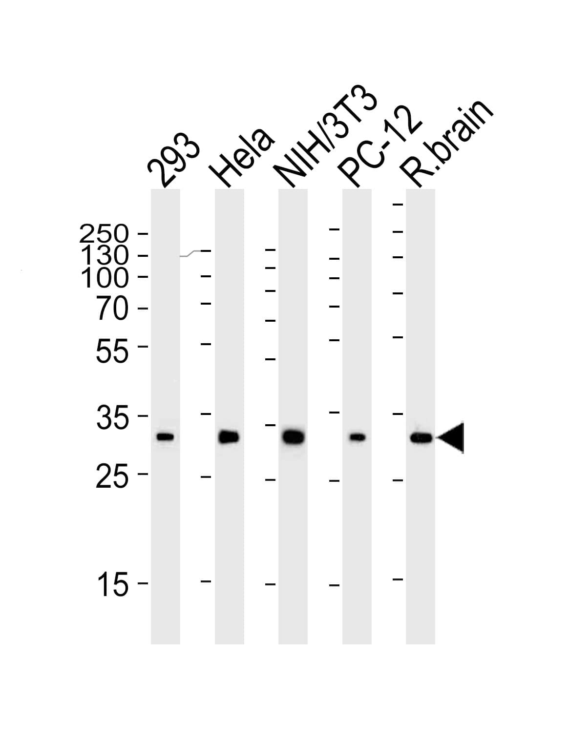 Monoclonal Mouse anti-Human RPS6 / Ribosomal Protein S6 Antibody (clone 981CT2.1.1, N-Terminus, IHC, IF, WB)
