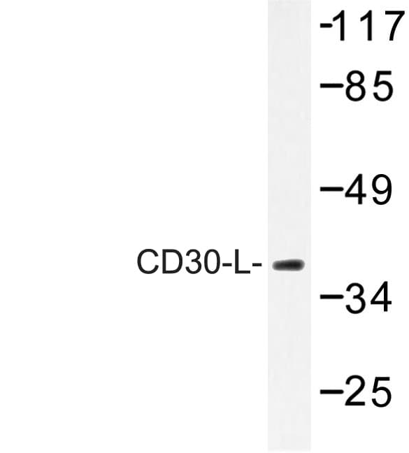 CD30L / CD153 Antibody (Gln103)