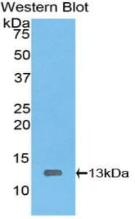 HMGIY / HMGA1 Antibody (aa1-107)