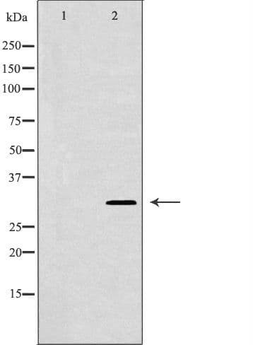 Polyclonal Rabbit anti-Human HUS1 Antibody (IHC, WB)