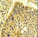 Polyclonal Rabbit anti-Human CNN1 / Calponin Antibody (aa10-39, IHC, WB)