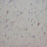NTF3 / Neurotrophin 3 Antibody (Internal)