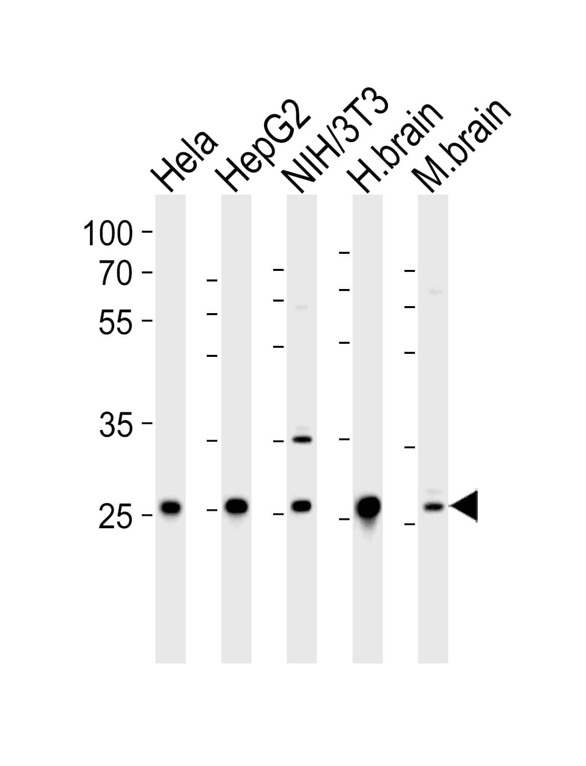 NDUFS3 Antibody (aa251-284)