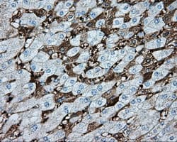 HMRF1L / MTRF1L Antibody (clone OTI2H8)