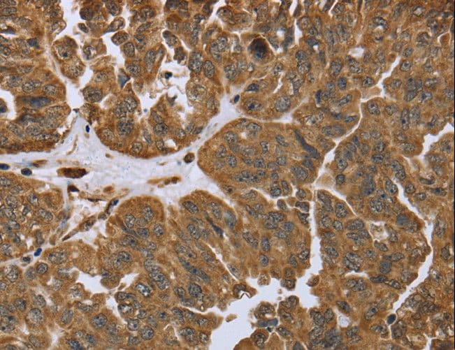 Polyclonal Rabbit anti-Human IKBIP Antibody (IHC)