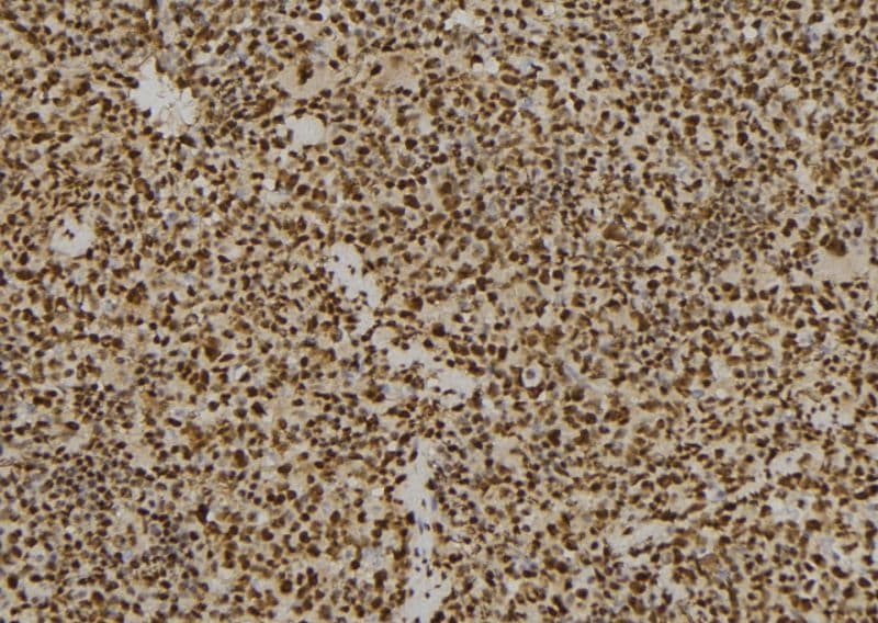PSMD7 / MOV34 Antibody