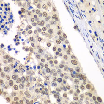 Polyclonal Rabbit anti-Human HDAC2 Antibody (IHC, IF, WB)