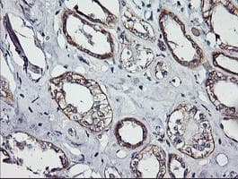 ERBB2 / HER2 Antibody (aa676-1255, clone OTI4F10, Carrier-free)