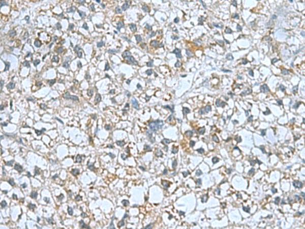 Polyclonal Rabbit anti-Human CNTN4 Antibody (IHC)