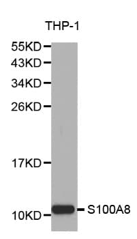 S100A8 / MRP8 Antibody