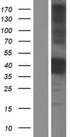 CTSB / Cathepsin B Protein (Over-Expression Lysate Myc-DDK (Flag))