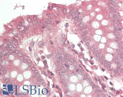 IHC-plus™ CYR61 Antibody (aa150-250)