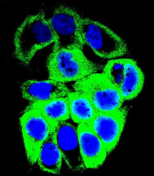 IHC-plus™ GALNS / Chondroitinase Antibody (aa236-263)