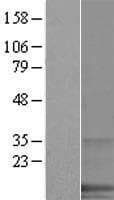 SPANXA1 Protein (Over-Expression Lysate Myc-DDK (Flag))