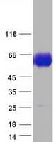 Human ACP2 / Acid Phosphatase 2 Protein (Recombinant Myc-DDK (Flag))