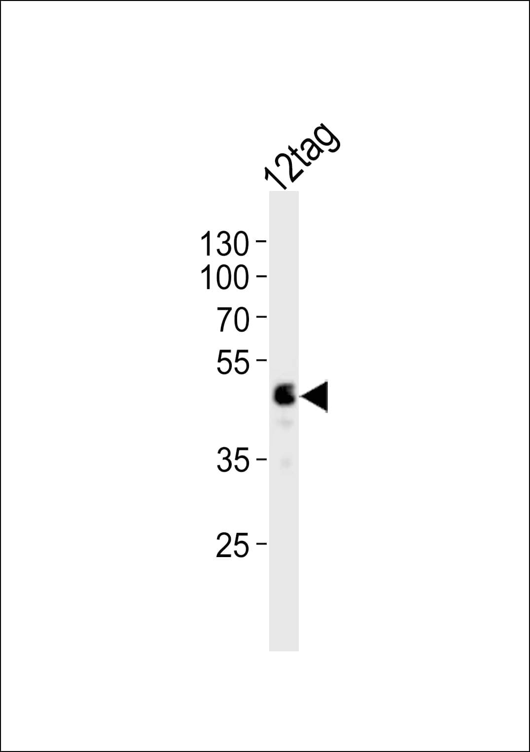 DYKDDDDK Tag Antibody