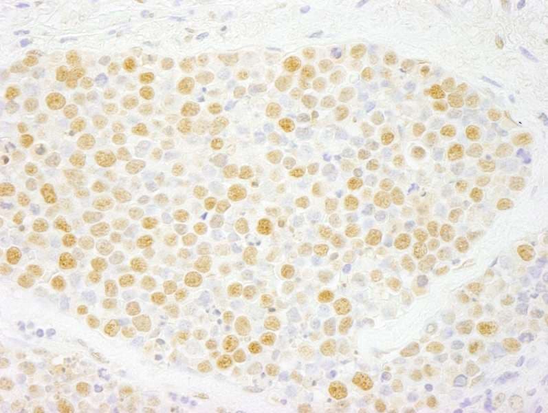ZMYM2 / RAMP Antibody (aa1327-1377)