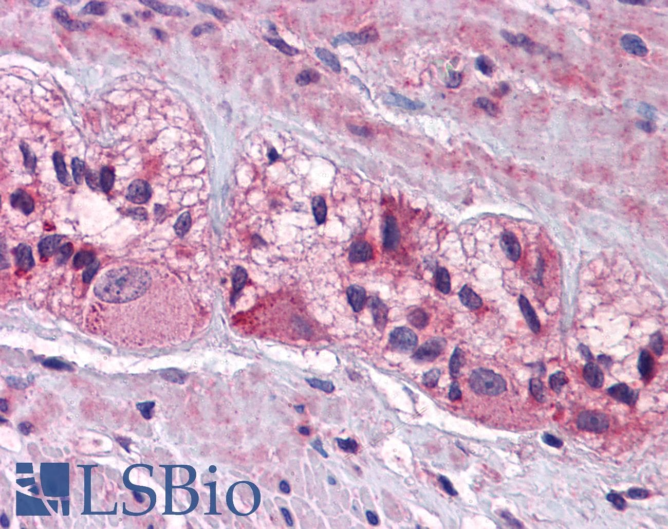 CHRNA3 Antibody (aa35-84)
