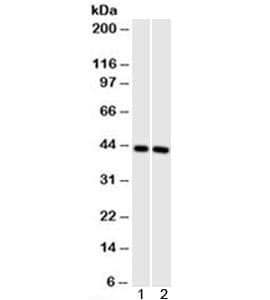 Monoclonal Mouse anti-Human Actin Antibody (clone HHF35, Azide-free,BSA-free, IHC, IF, WB)