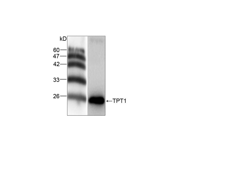 IHC-plus™ Monoclonal Mouse anti-Human TPT1 / TCTP Antibody (clone 18, IHC, WB)