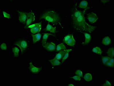 CDKN1A / WAF1 / p21 Antibody