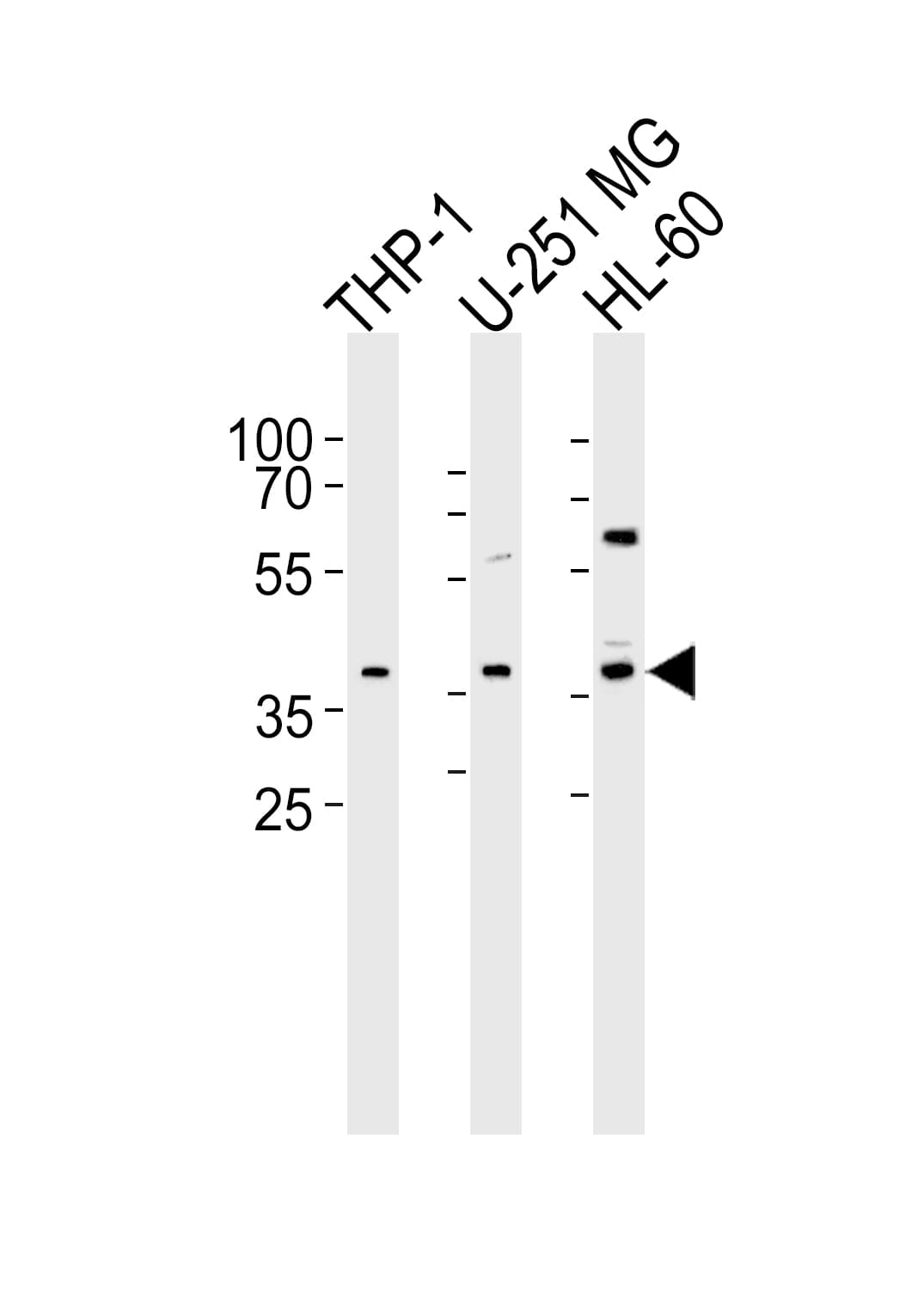 RAD9B Antibody (aa394-428)