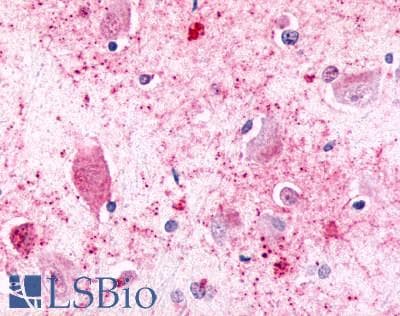 PathPlus™ CELSR3 Antibody (N-Terminus)