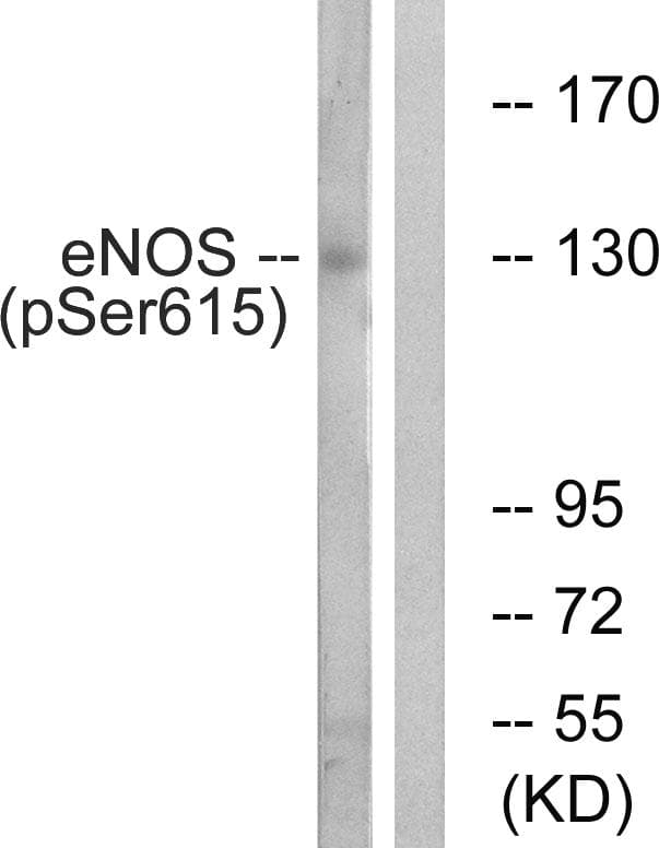 Polyclonal Rabbit anti-Human NOS3 / eNOS Antibody (phospho-Ser615, WB)