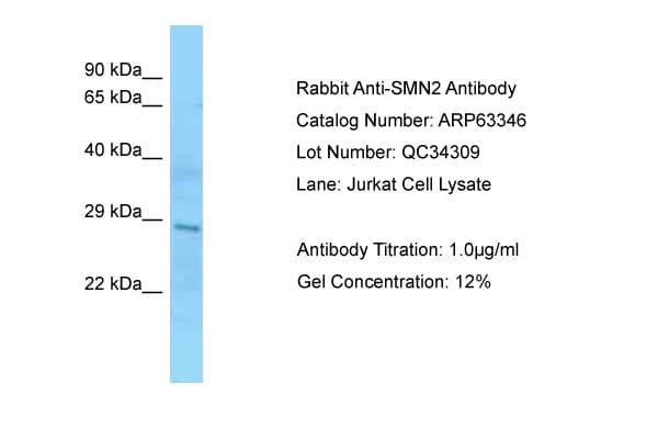 Polyclonal Rabbit anti-Human SMN1/SMN2 Antibody (aa51-100, WB)