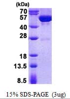 Human GDA / Nedasin Protein (Recombinant His)