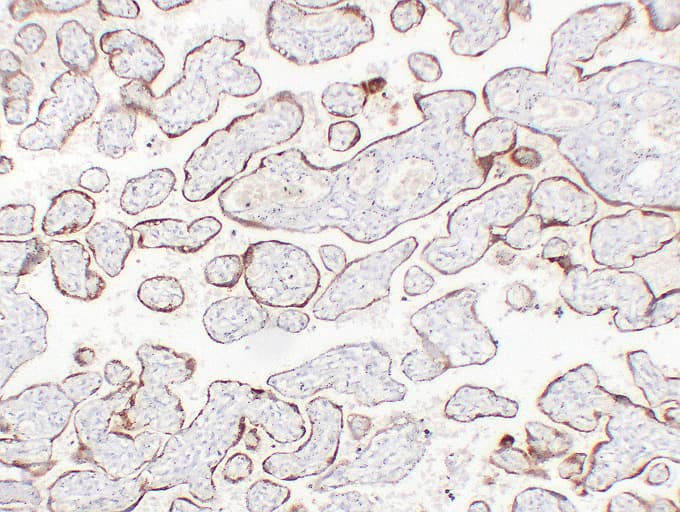 CGB / hCG Beta Antibody (clone ABT-HCGβ)