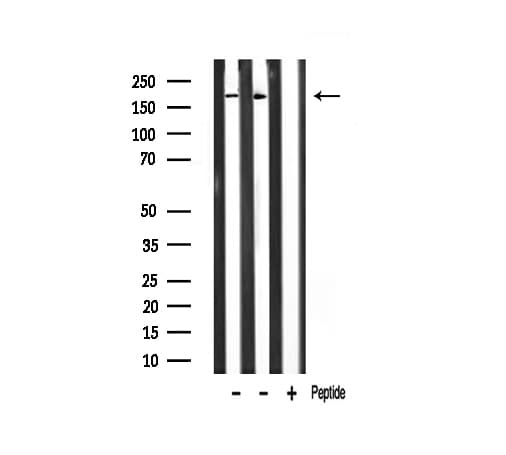 Polyclonal Rabbit anti-Human TAF1 Antibody (IHC, IF, WB)