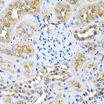 NIN / Ninein Antibody