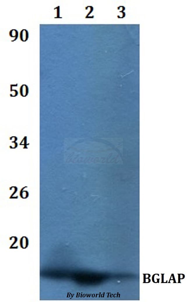 Polyclonal Rabbit anti-Human Osteocalcin Antibody (WB)