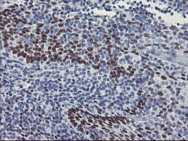 MEIS3 Antibody (aa1-261, clone OTI3E12, Carrier-free)