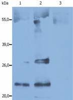 CD9 Antibody (clone IVA50)