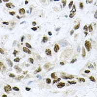 HR6B / UBE2B Antibody