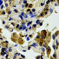 Polyclonal Rabbit anti-Human CASP3 / Caspase 3 Antibody (Internal, IHC, WB)