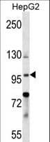 BNC1 / Basonuclin Antibody (aa1-30)