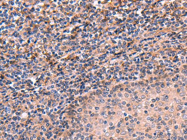 ARIH2 Antibody