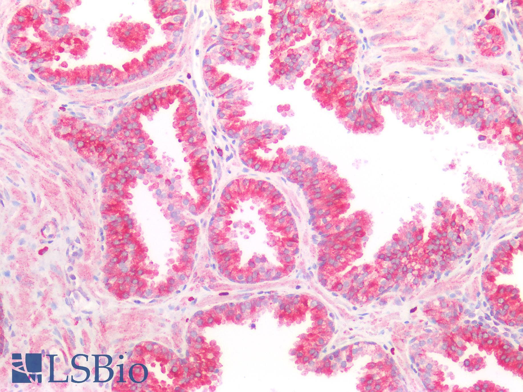 PathPlus™ LDLR / LDL Receptor Antibody (aa810-860)