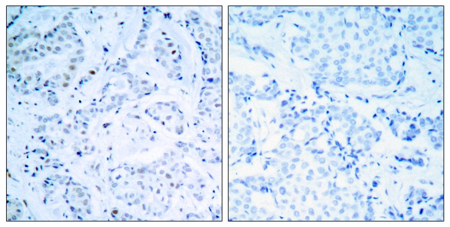 ER Alpha / Estrogen Receptor Antibody (p104)