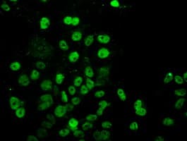 UBE2E3 Antibody (clone OTI4C8)