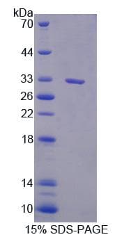 Human PLCD1 Protein (Recombinant)