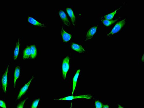 FGFR1 / FGF Receptor 1 Antibody