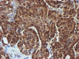 FBXO21 Antibody (clone OTI5H4)