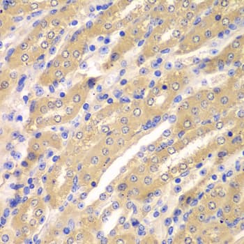 Polyclonal Rabbit anti-Human ERGIC2 Antibody (IHC, WB)
