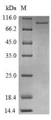 Human DDX3 / DDX3X Protein (Recombinant 6His-B2M, N-terminus)