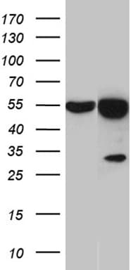 Monoclonal Mouse anti-Human HNRNPH1 / hnRNP H Antibody (clone OTI2D11, IHC, WB)